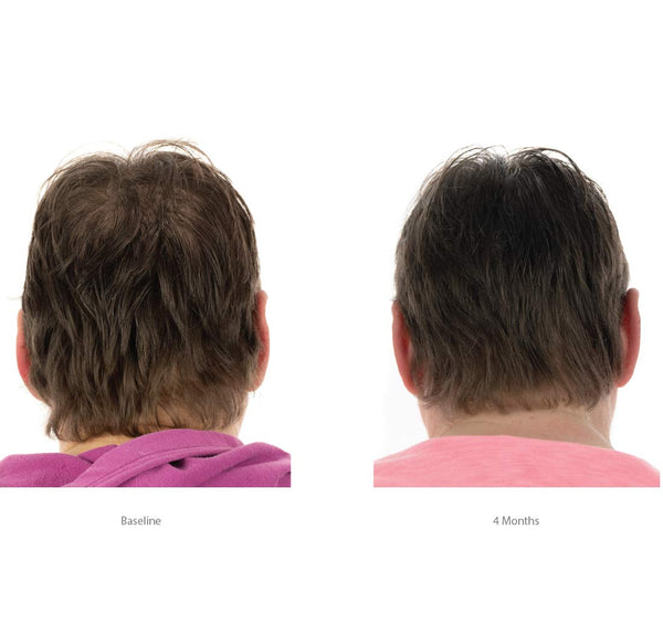 FOLIGAIN Triple Action Conditioner voor dunner wordend haar voor vrouwen met 2% Trioxidil 473 ml