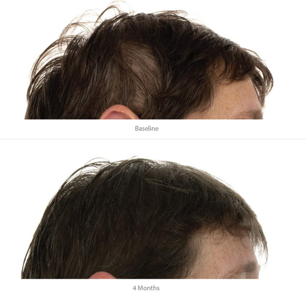 FOLIGAIN Triple Action Conditioner voor dunner wordend haar voor vrouwen met 2% Trioxidil